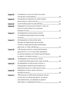 Complications pleurales des kystes hydatiques thoraciques