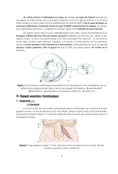 Le syndrome de la jonction pyélo-urétérale chez l'enfant