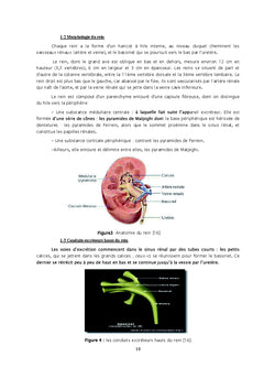 Le syndrome de la jonction pyélo-urétérale chez l'enfant