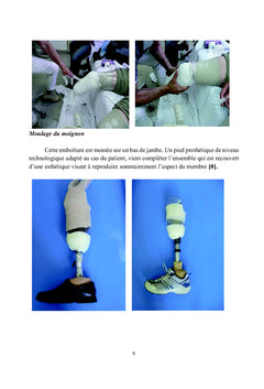 Prise en charge des Amputes vasculaires