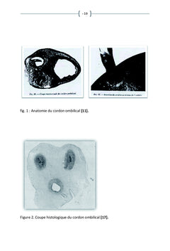 Procidence du cordon ombilical à l'HGPRK (2000-2005)