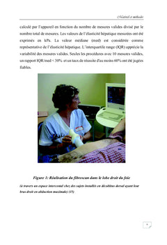 Quelle valeur seuil du Fibroscan hépatique chez le sujet sain ?