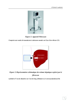 Quelle valeur seuil du Fibroscan hépatique chez le sujet sain ?