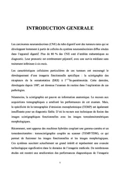Cancer neuroendocrine digestif : valeur additionnelle de la TeMP/TDM