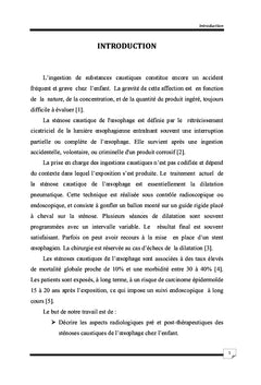 Dilatation des sténoses caustiques de l'oesophage chez l'enfant