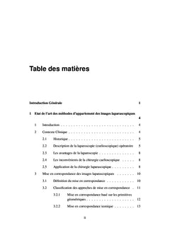 Appariement d'images stereoscopiques pour la reconstruction 3D