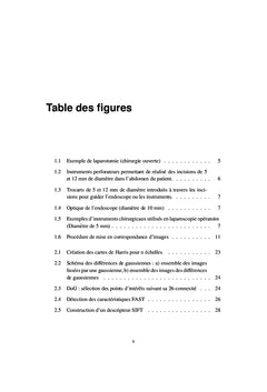 Appariement d'images stereoscopiques pour la reconstruction 3D