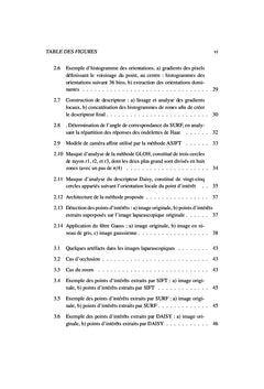 Appariement d'images stereoscopiques pour la reconstruction 3D