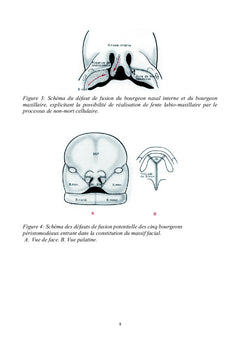 Tumeurs congénitales et malformations de la cavité buccale