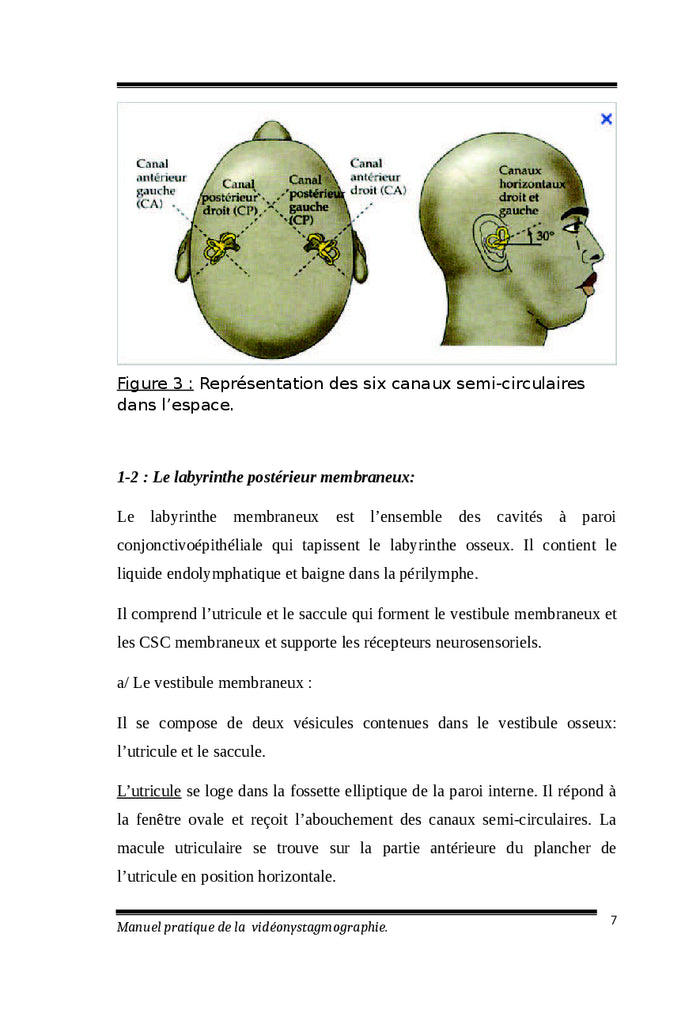 Manuel pratique de la vidéonystagmographie