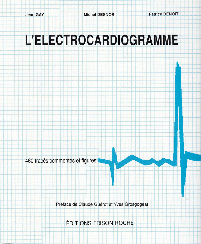 L'electrocardiogramme : savoir l'interpreter (460 traces commentes et figures)