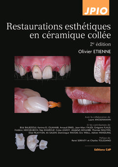 Restaurations esthétiques en céramique collée