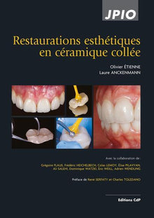 Restaurations esthétiques en céramique collée
