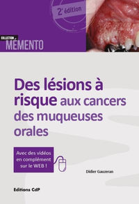 Des lésions à risque aux cancers des muqueuses orales