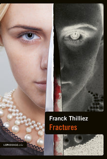 Fractures