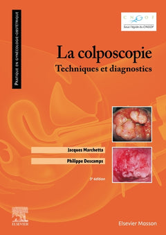 La colposcopie