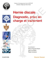 La hernie discale lombaire