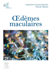Oedèmes maculaires: Rapport SFO 2016