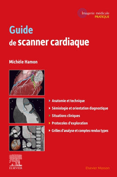 Guide de scanner cardiaque