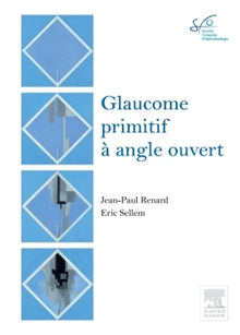 Glaucome primitif à angle ouvert: Rapport SFO 2014