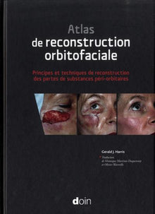 Atlas de reconstruction orbitofaciale