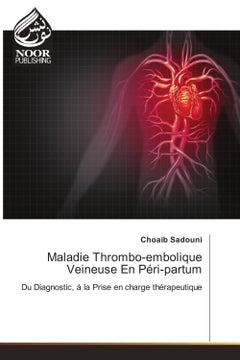 Maladie thrombo-embolique veineuse en péri-partum