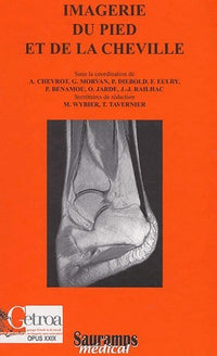 IMAGERIE DU PIED ET DE LA CHEVILLE MONOGRAPHIE DU GETROA