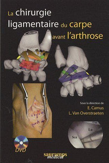 La chirurgie ligamentaire du carpe