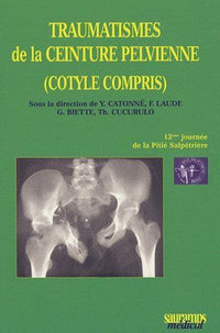 Traumatisme de la ceinture pelvienne