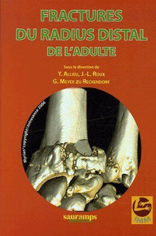 FRACTURES DU RADIUS DISTAL DE L ADULTE