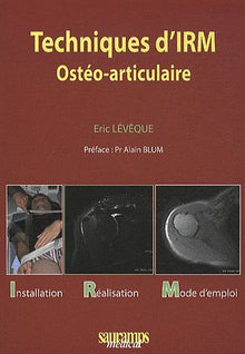 Techniques d'IRM ostéo articulaire