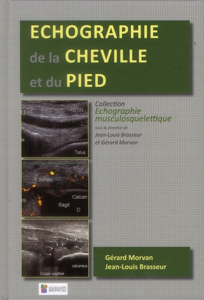 Echographie de la cheville et du pied