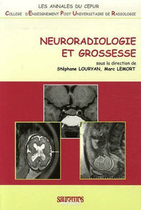 Neuroradiologie et grossesse