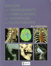 Imagerie des remaniements et complications des radiations en radiothérapie