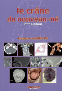 Le crane du nouveau ne 2e ed