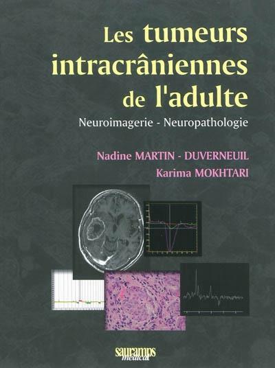 Les tumeurs intracrâniennes de l'adulte