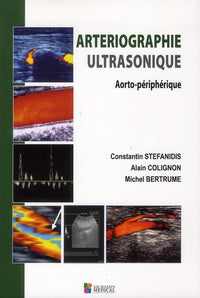 Arteriographie ultrasonique