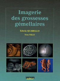 Imagerie des grossesses gemellaires