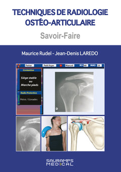 Techniques en radiologie ostéo articulaire