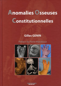 Anomalies osseuses constitutionnelles