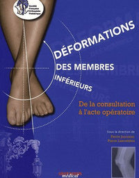 Deformations des membres inferieurs