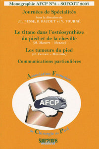 Le titane dans l'ostéosynthèse du pied et de la cheville : Les tumeurs du pied SOF