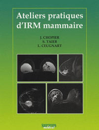 Ateliers pratiques d'IRM mammaire