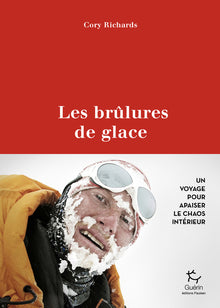 Les brûlures de glace