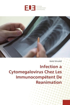 Infection à cytomégalovirus chez les immunocompétents de réanimation