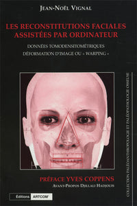 Les reconstitutions faciales assistées par ordinateur
