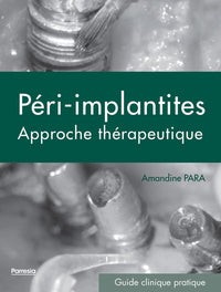 Les péri-implantites