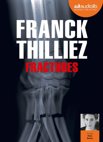Fractures