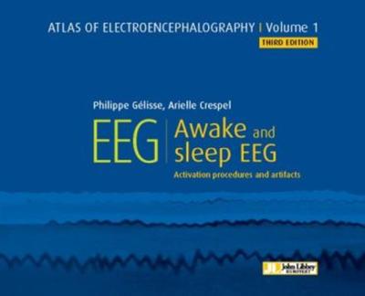 Atlas of electroencephalography - Volume 1