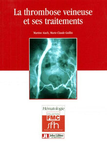 La thrombose veineuse et ses traitements